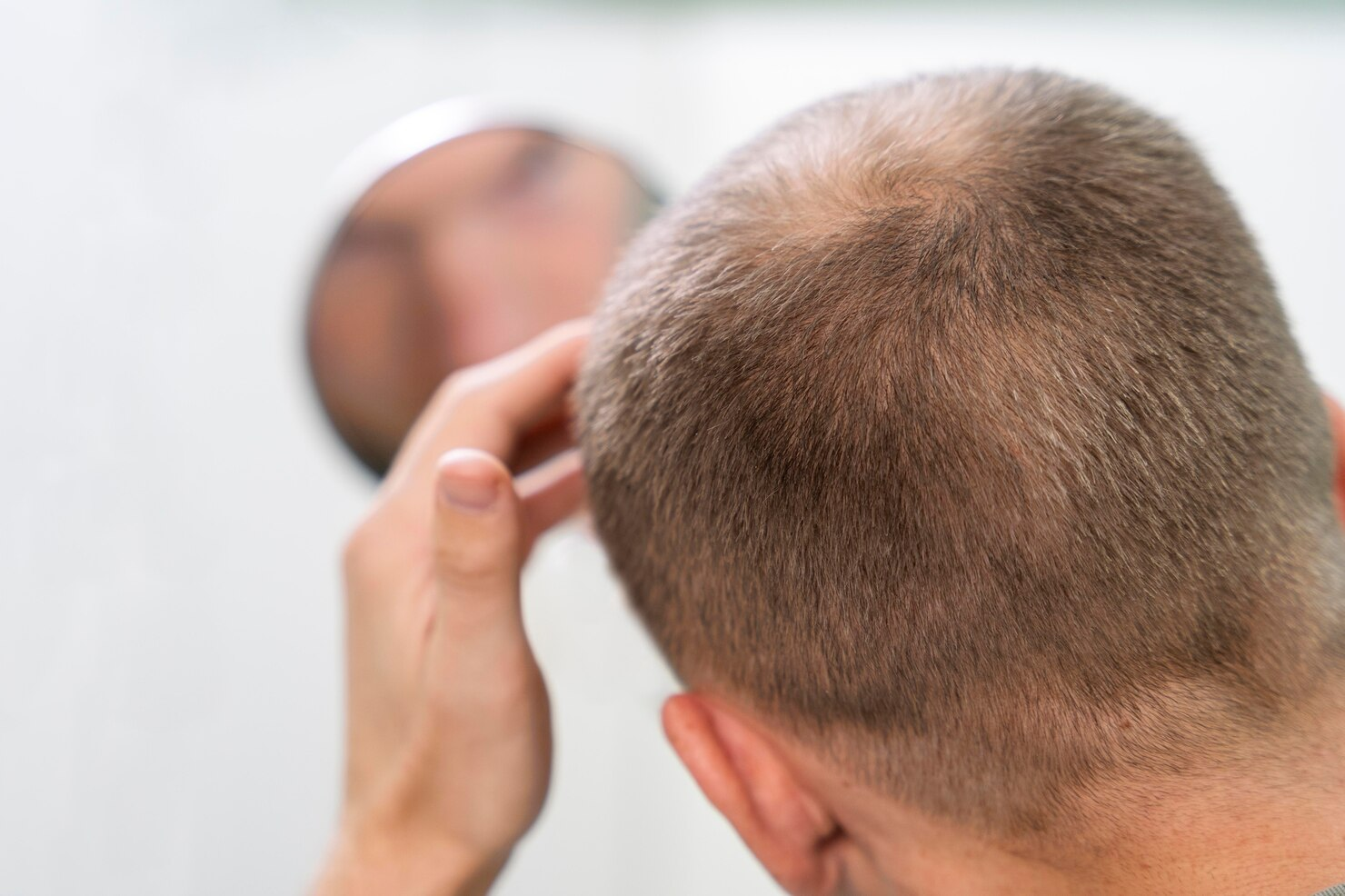 Choosing The Right Hair Loss Clinic For Your FUT Hair Transplant In Melbourne